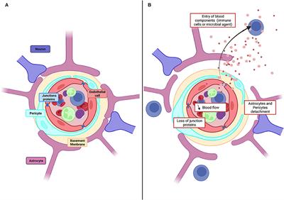 Study of BBB Dysregulation in Neuropathogenicity Using Integrative Human Model of Blood–Brain Barrier